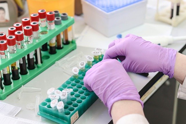 “Lifespan hospitals are actually seeing a downturn in the number of patients, running about 40% below normal capacity” & Newly approved COVID-19 test could increase testing 1,100% A DAY